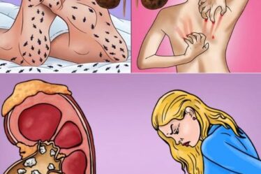 7 Sinais de Que Seus Rins Estão Pedindo Ajuda
