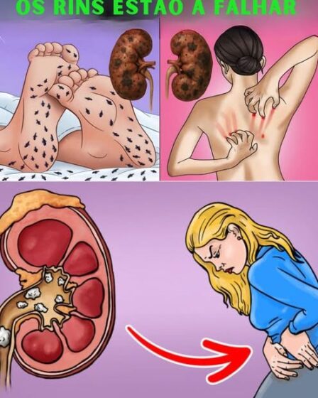 7 Sinais de Que Seus Rins Estão Pedindo Ajuda