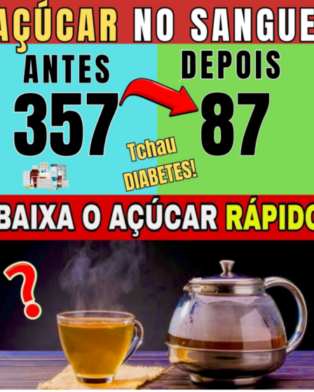 Essa é a MANEIRA mais RÁPIDA de abaixar o AÇÚCAR no SANGUE!